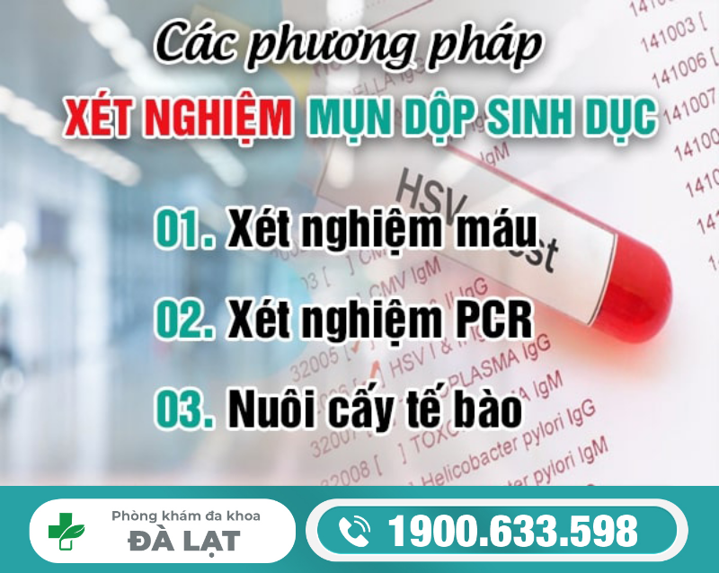 Hình ảnh minh họa
